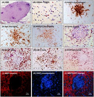 What do animal models tell us about the role of EBV in the pathogenesis of multiple sclerosis?